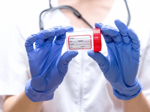 Test de microbiota intestinal para saber cómo recuperar la microbiota intestinal